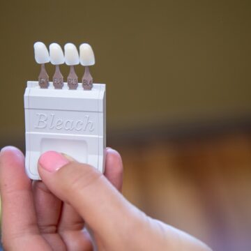 Dental Veneers in Great Neck, NY