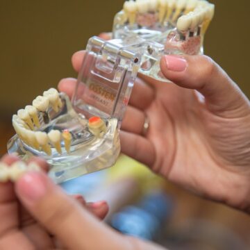 The dentist is showing full teeth model in hand.
