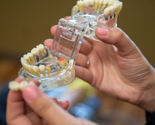 The dentist is showing full teeth model in hand.