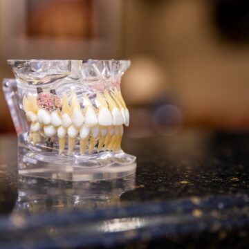 Full Dental teeth model at the Great Neck Dental Associates