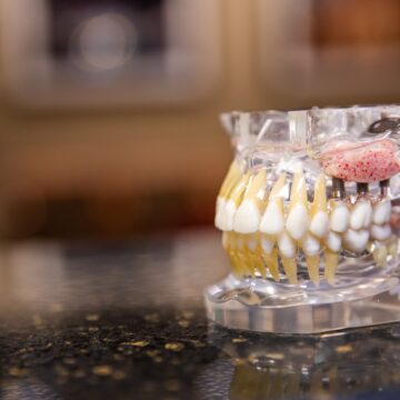 The full mouth tooth model
