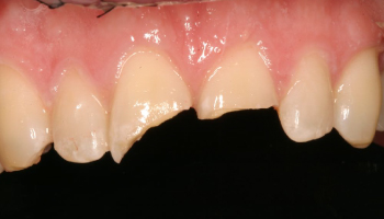 Before-test