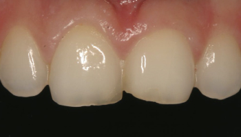 Before-test