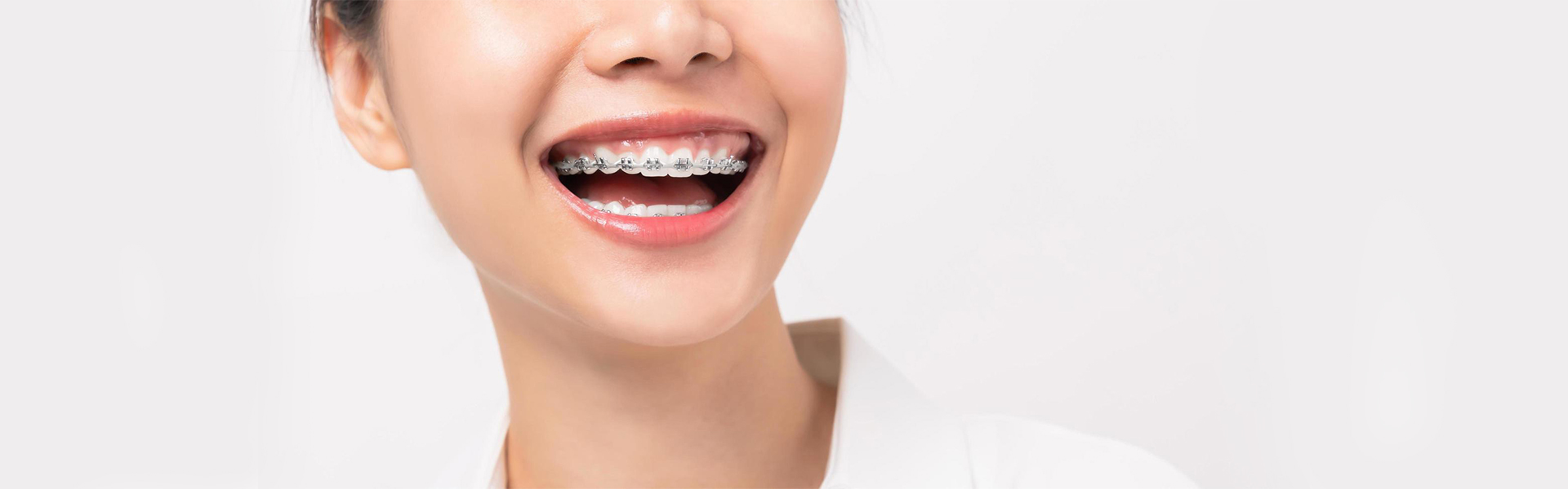 A Basic Guide to Orthodontics