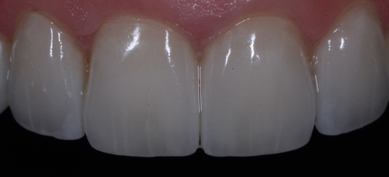 After image