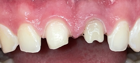 Before image