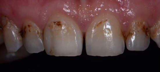 Before image