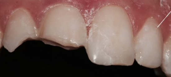 Before image