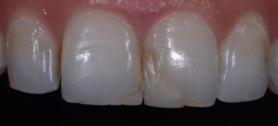 Before image