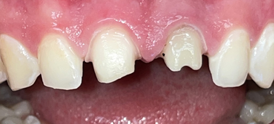 Before image