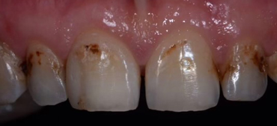 Before image