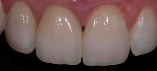 After image