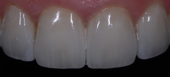 After image