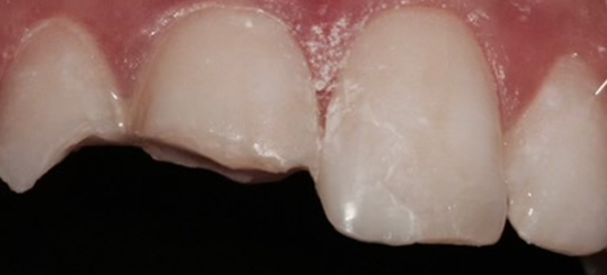 Before image
