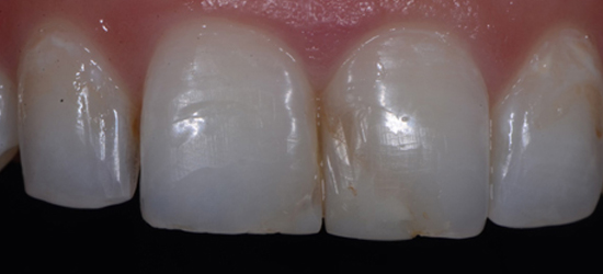 Before image