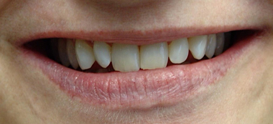 Before image