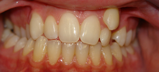 Before image