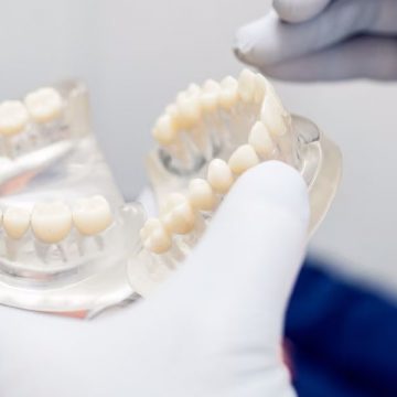 What is dental bone grafting, and how does it work?