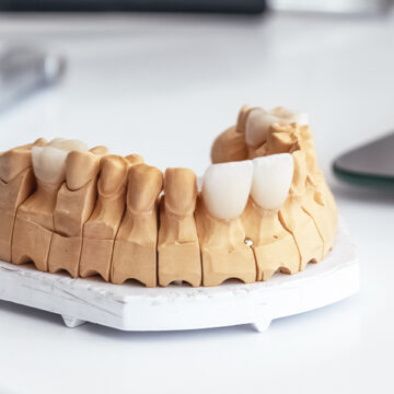 What do Lumineers do on your teeth?