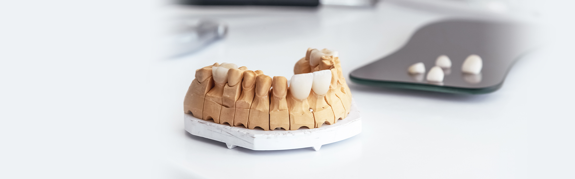 What do Lumineers do on your teeth?