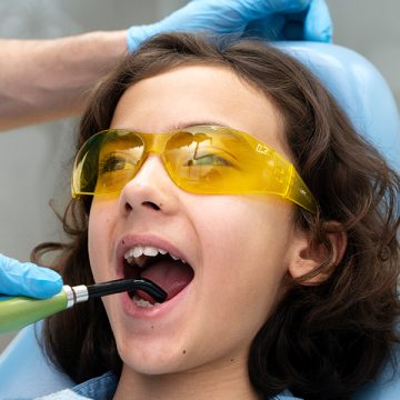 Are Dental Sealants Necessary for Kids’ Teeth?